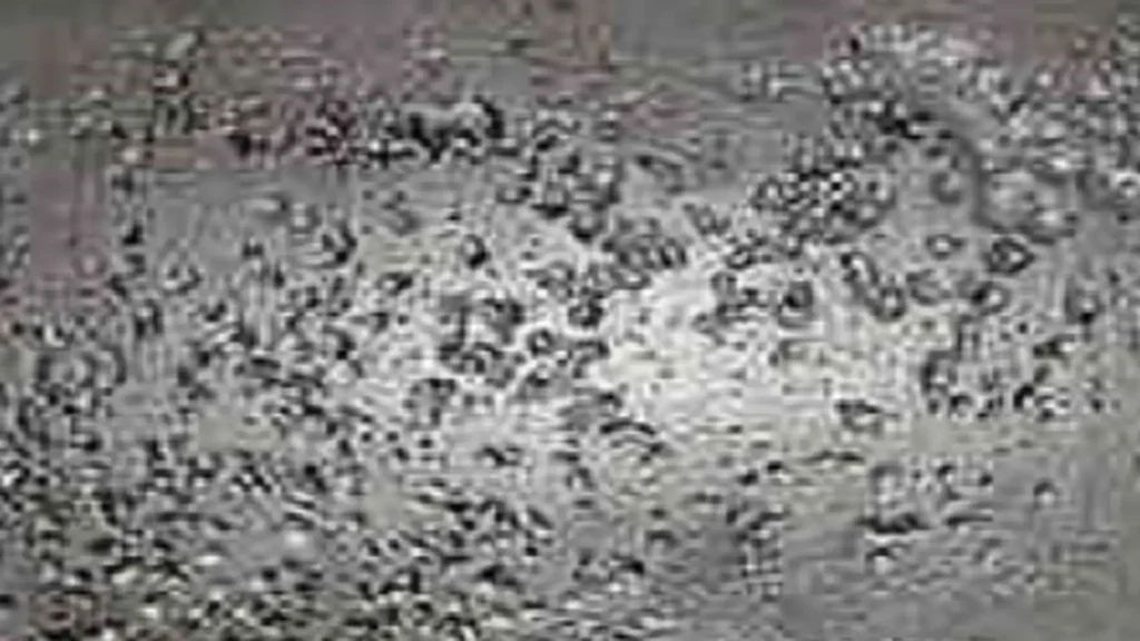 Fotomicrografía de corrosión por picaduras en acero