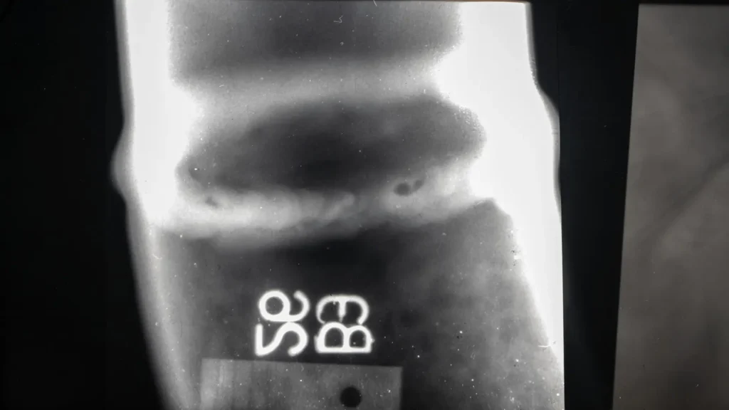 Inspección radiográfica de buena soldadura vs. mala soldadura
