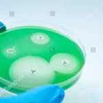 La bacteria Pseudomonas aeruginosa, habitual en la naturaleza, pero manipulada aquí en una cepa no infecciosa.